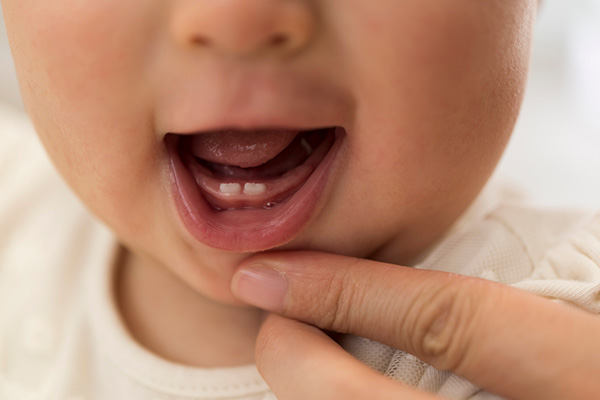 子供の歯を健康な状態にしてあげたい